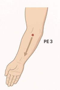 Akupunktur Bluthochdruck Michael Schuller Akupunktur TCM